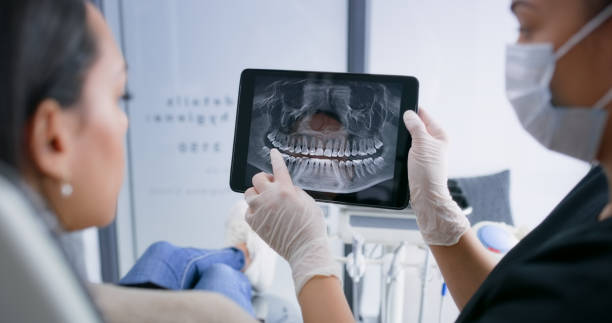 Licensed Tooth Extraction service in Westerville, OH - Smile Center Dentistry